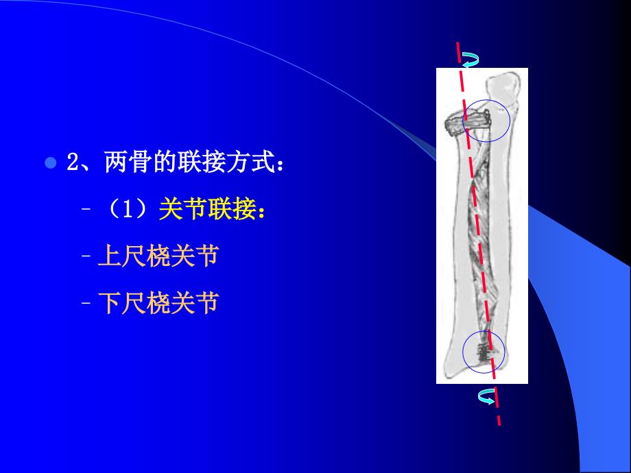 中医伤科学-尺桡骨双骨折课件_第3页