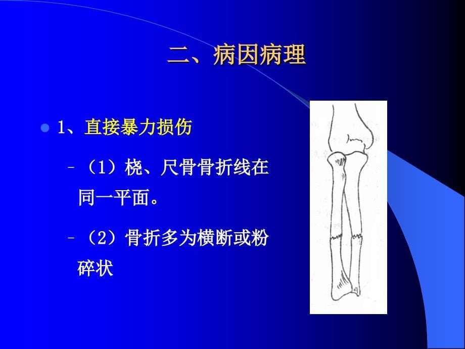 中医伤科学-尺桡骨双骨折课件_第5页