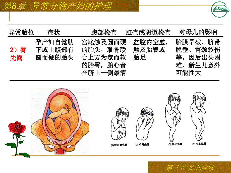 胎儿异常患者的护理课件_第4页