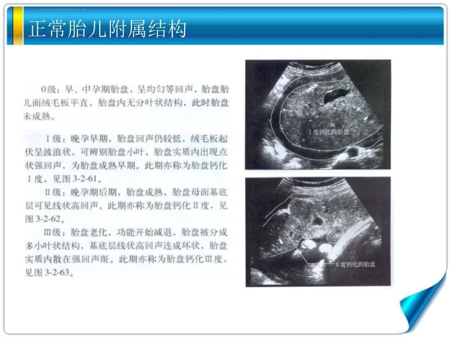 胎儿附属结构课件_第5页