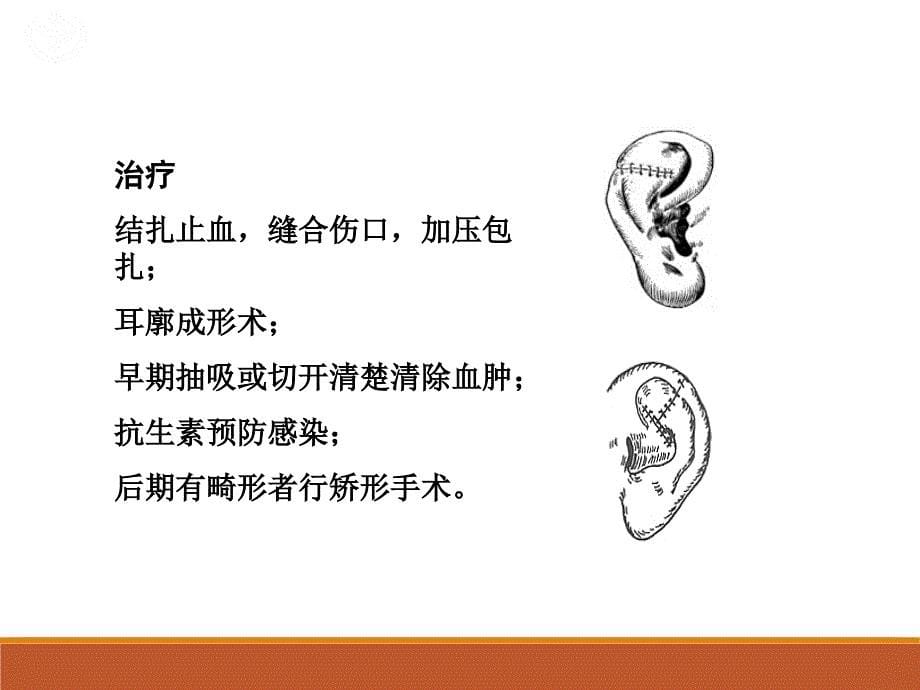 耳部疾病诊断体会_第5页