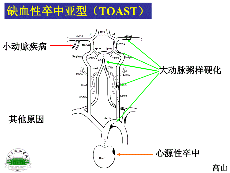 缺血性卒中诊治三重奏-201005_第4页