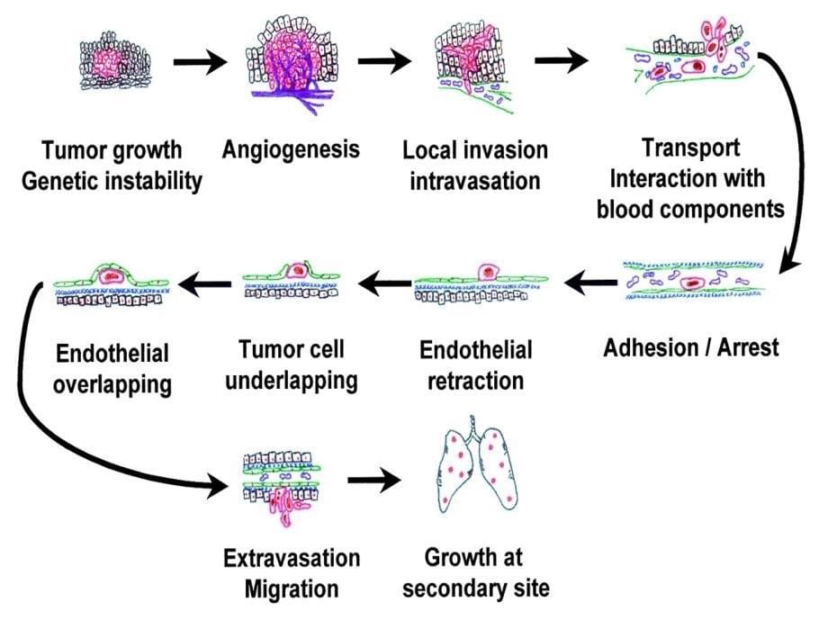 3.肿瘤转移的分子基础_第5页