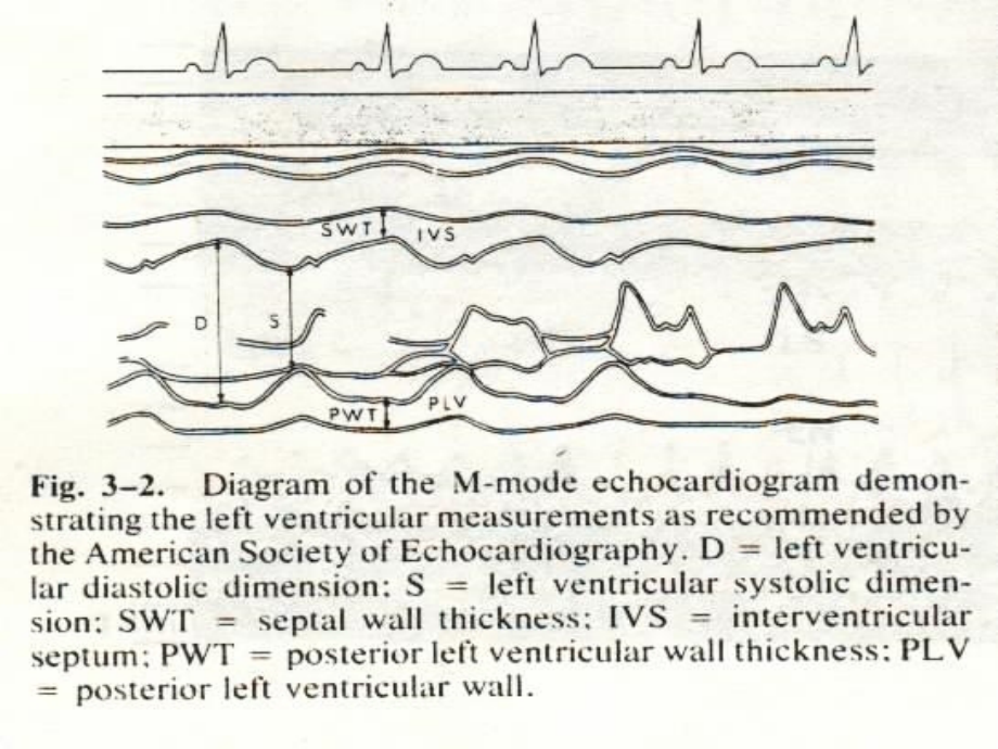 超声心动图测定心功能与心内压力的测定郭瑞强2009湖北_第4页