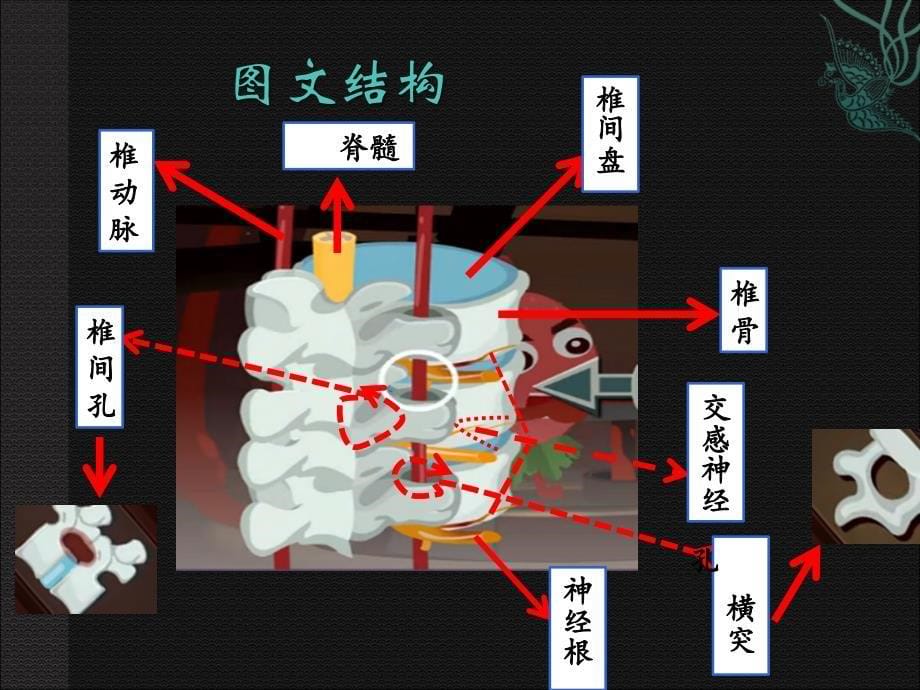 颈椎病完整版_第5页