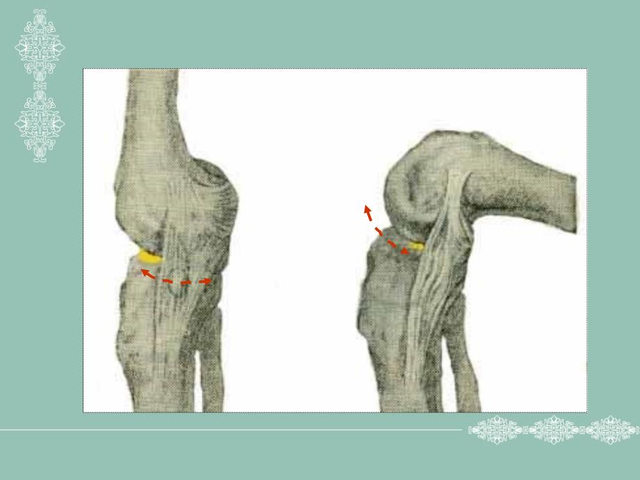 中医学课件-膝关节半月板损伤课件_第3页