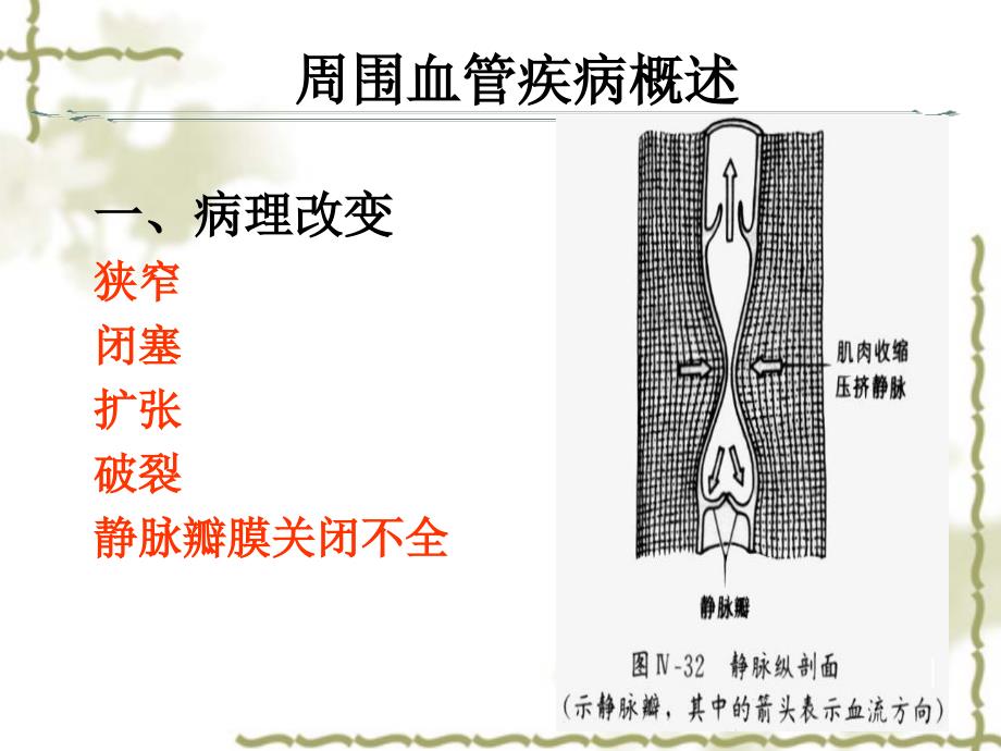 成人护理学-周围血管和淋巴管疾病ppt课件_第4页