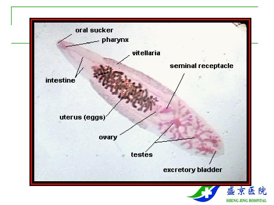 传染病-肝吸虫病ppt课件_第4页