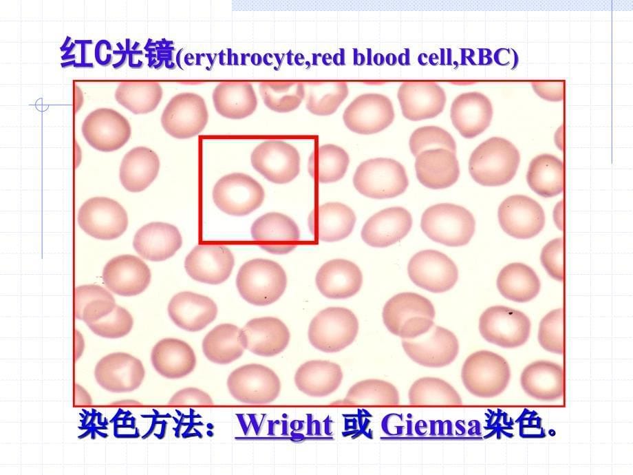 血液、淋巴和血发生--组织学与胚胎学_第5页