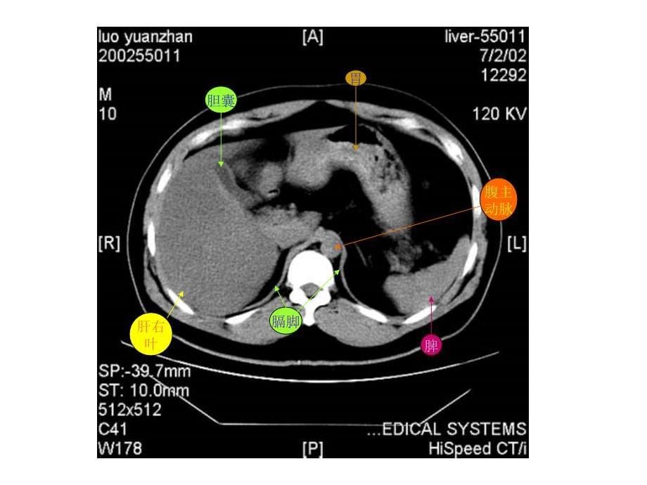 腹部ct-断层解剖结构(1)_第5页