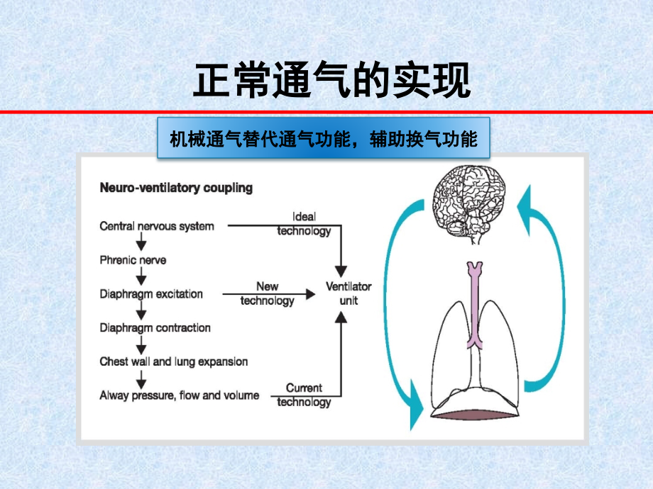 儿童机械通气课件_第2页