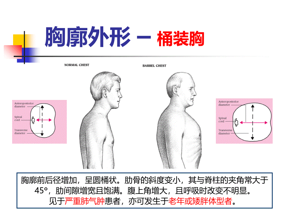 肺部阳性体征课件_第4页