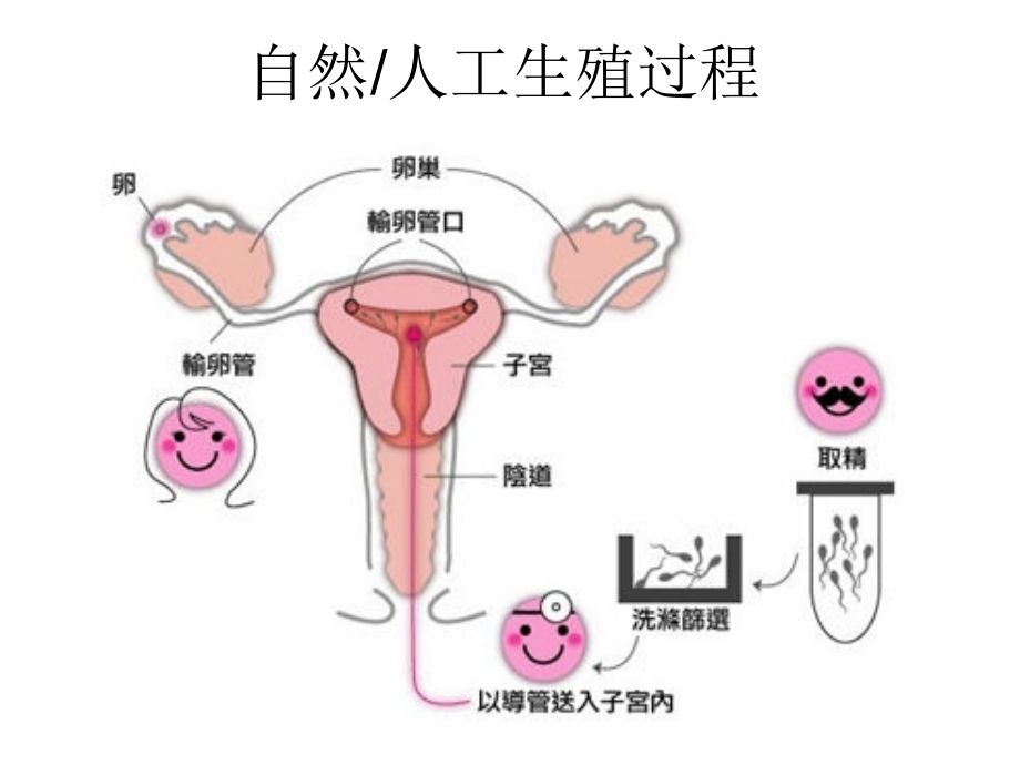 辅助生殖技术幻灯片_第4页