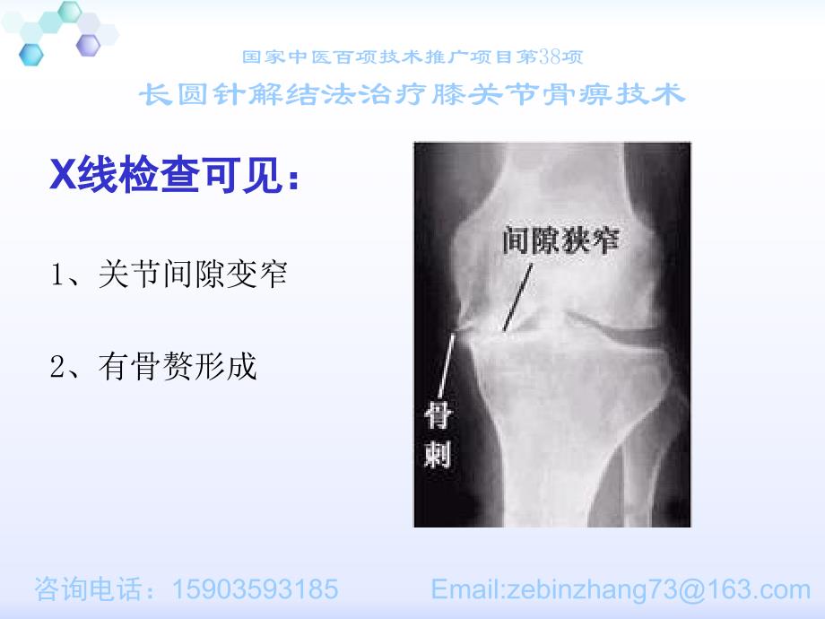 [中医中药]膝关节疼痛的诊治与预防_第4页