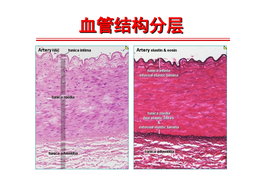 系统性血管炎诊治进展-梅长林课件_第4页