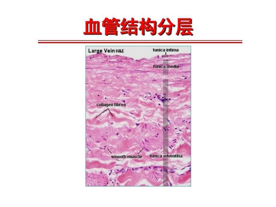 系统性血管炎诊治进展-梅长林课件_第5页
