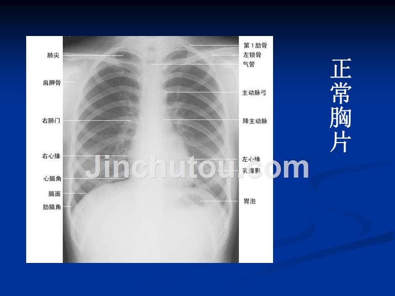 x线培训临床执业医师实践技能考试参考_第2页