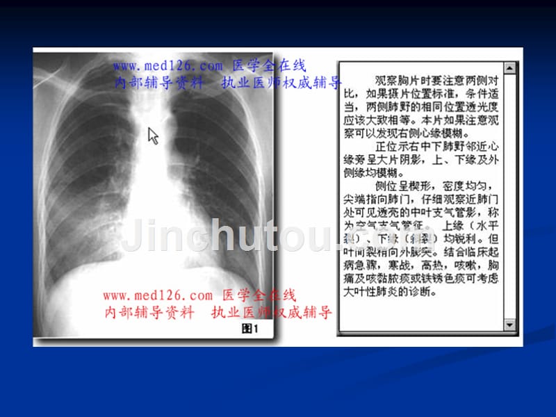 x线培训临床执业医师实践技能考试参考_第3页