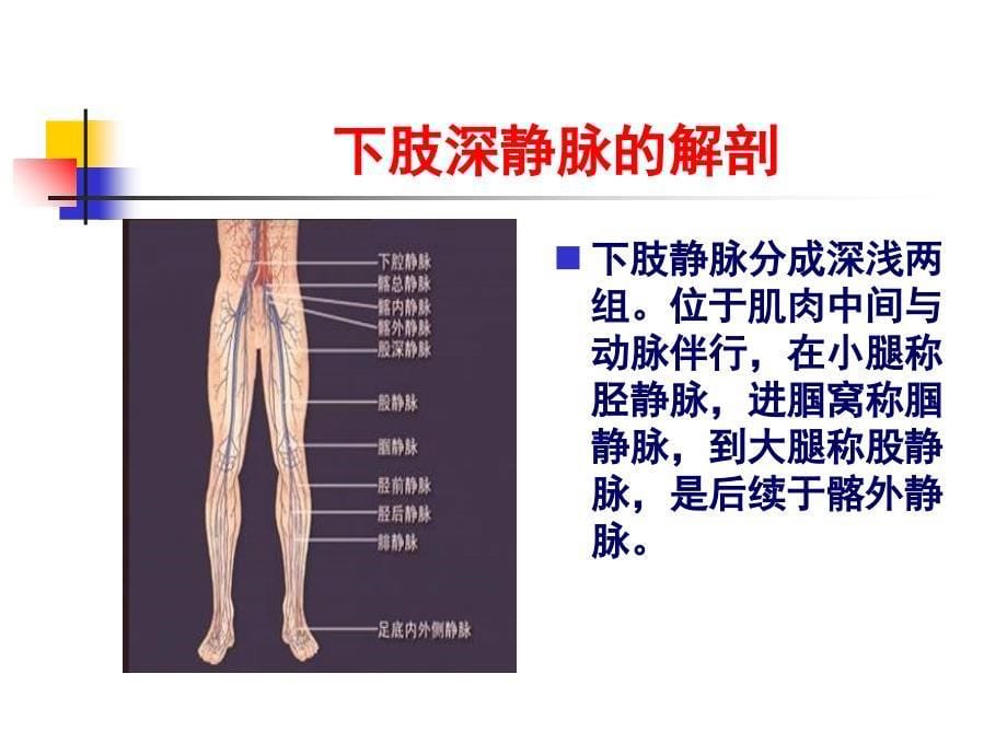 下肢深静脉血栓讲课课件_第5页