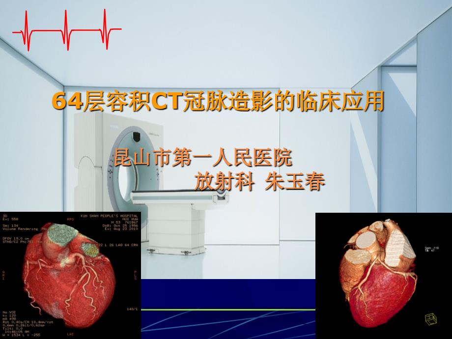 层容积ct冠脉造影的临床应用课件_第1页