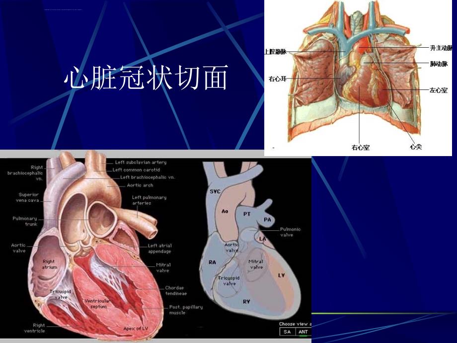 层容积ct冠脉造影的临床应用课件_第4页