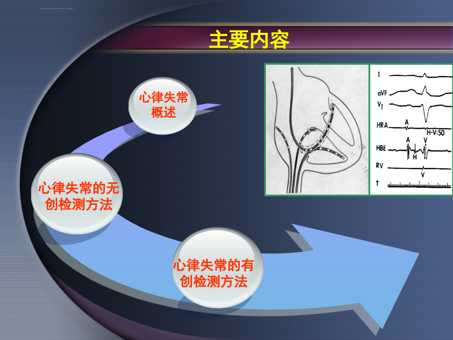 心律失常的有创和无创检测方法课件_第2页