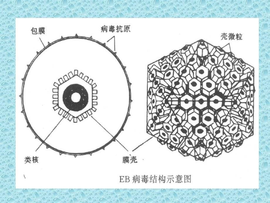 传染性单核细胞增多症-夏雅课件_第5页