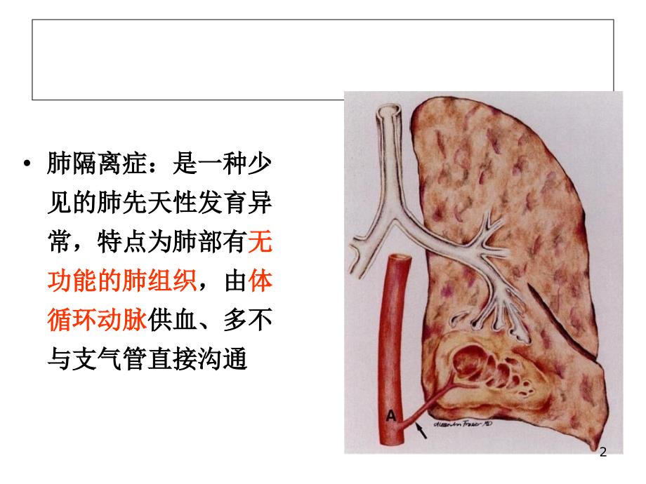 肺隔离症的影像表现课件_第2页