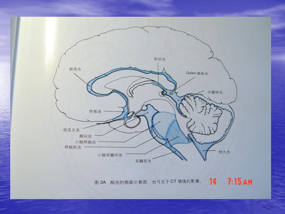 脑池显微神经外科解剖课件_第2页