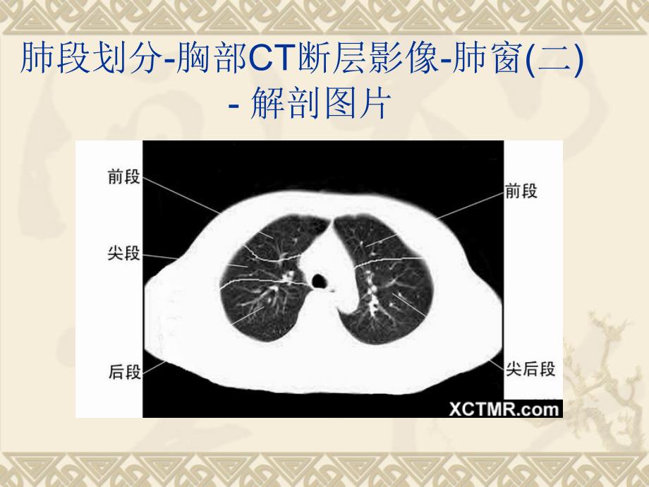 胸、上腹和盆腔ct详细实用图解课件_第4页