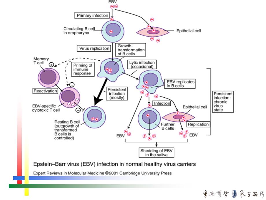 eb病毒感染的特殊表现.课件_第3页