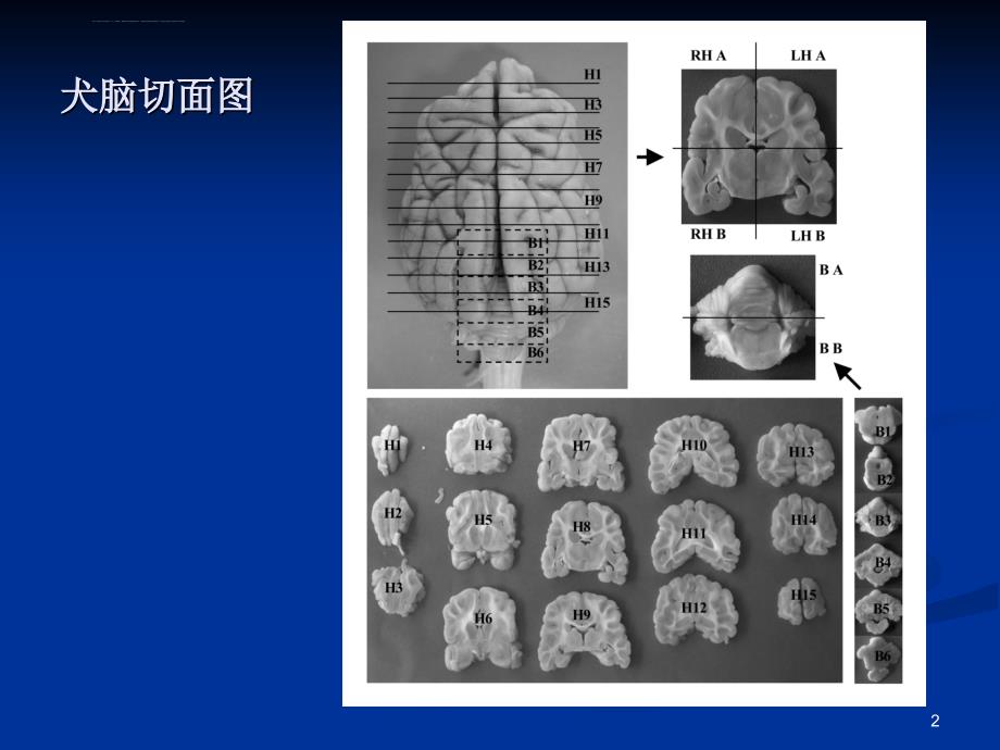 内科-神经系统教学大全综述课件_第2页