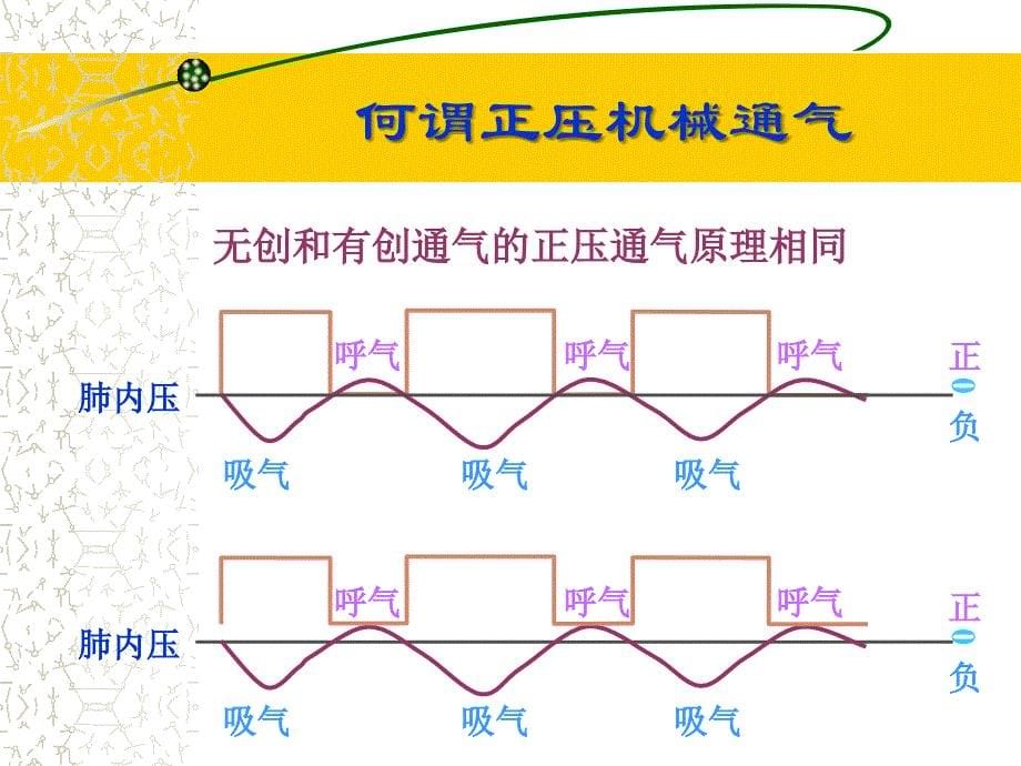 无创通气技术课件_第5页