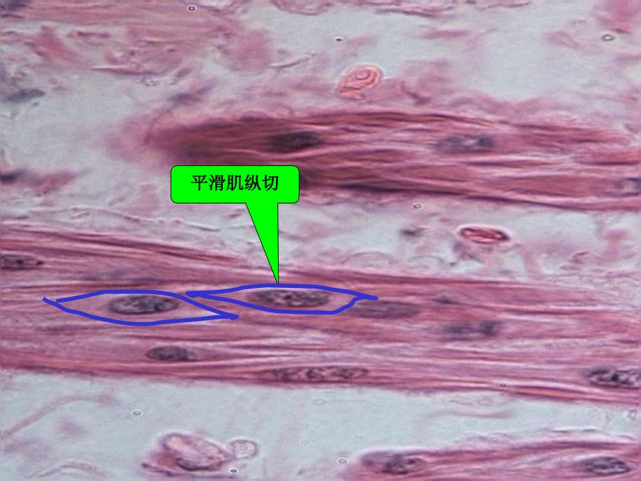 muscle tissue 平滑肌分离标本平滑肌纵切平滑肌横切平滑肌电镜照片 b...b_第3页