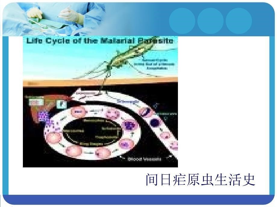 传染病护理学13第十三节--疟疾病人的护理课件_第5页