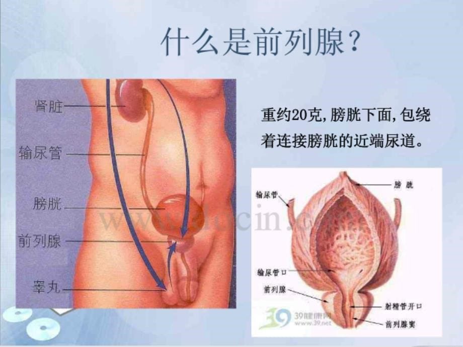 前列腺增生的护理查房--最终版课件_第5页