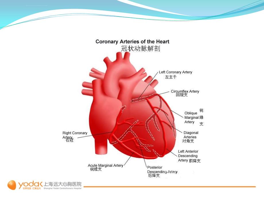 心脏搭桥手术2-上海远大心胸医院课件_第4页