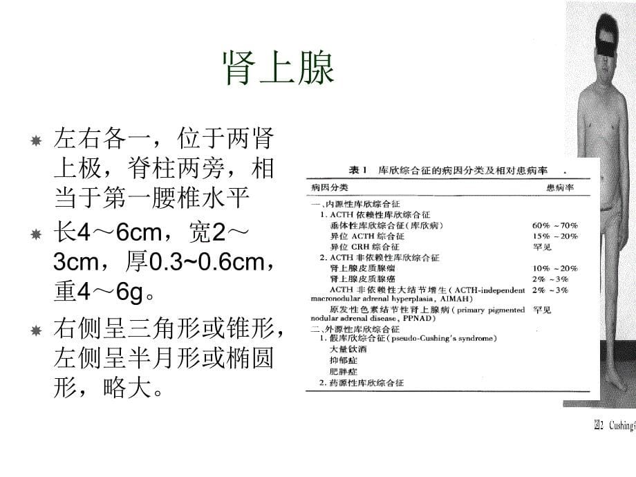 皮质醇增多症七年制课件_第5页