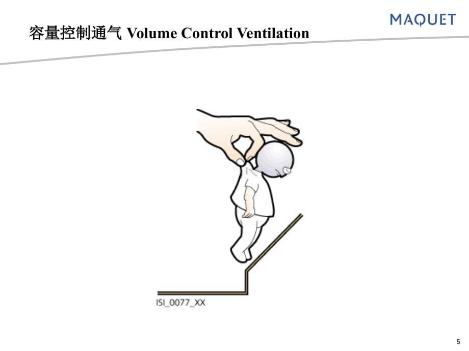 呼吸模式-301呼吸机讲课课件_第5页