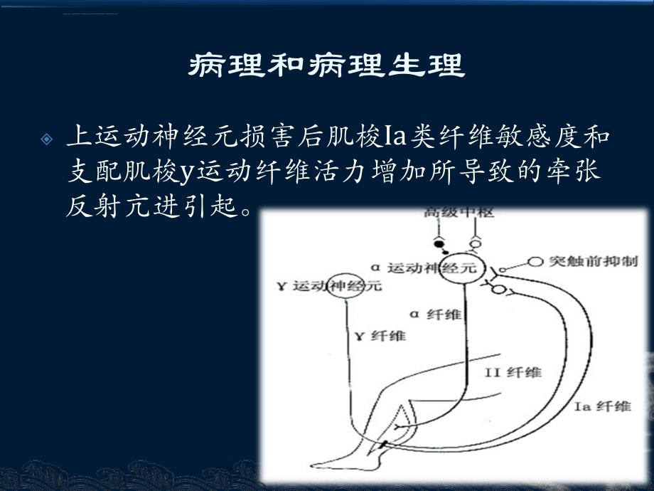 痉挛康复及肉毒素的应用课件_第4页