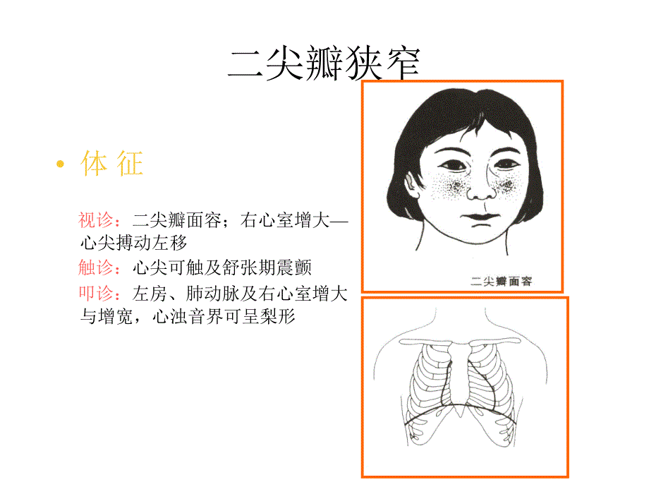 诊断学-循环系统常见疾病课件_第4页