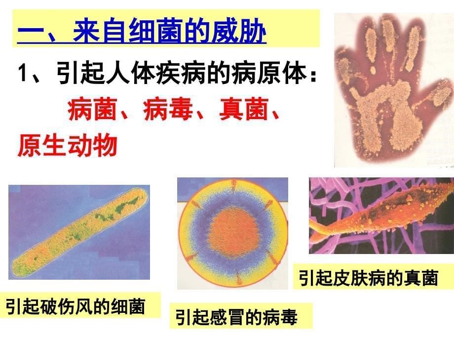 来自微生物的威胁（30张ppt）_第5页