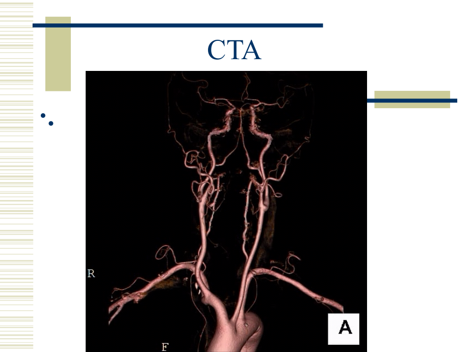 脑血管应用解剖2016.12.24_第4页