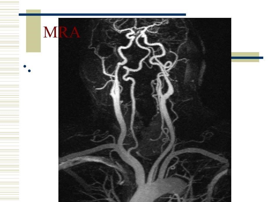 脑血管应用解剖2016.12.24_第5页