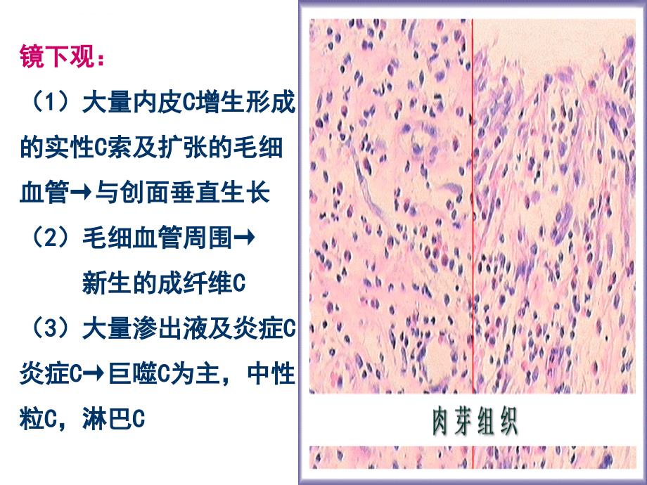 损伤的修复幻灯片_第3页