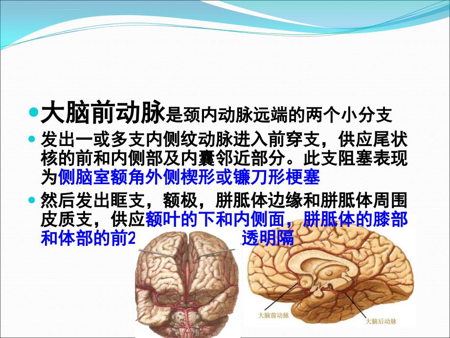 颅脑常见血管疾病ct诊断课件_第4页