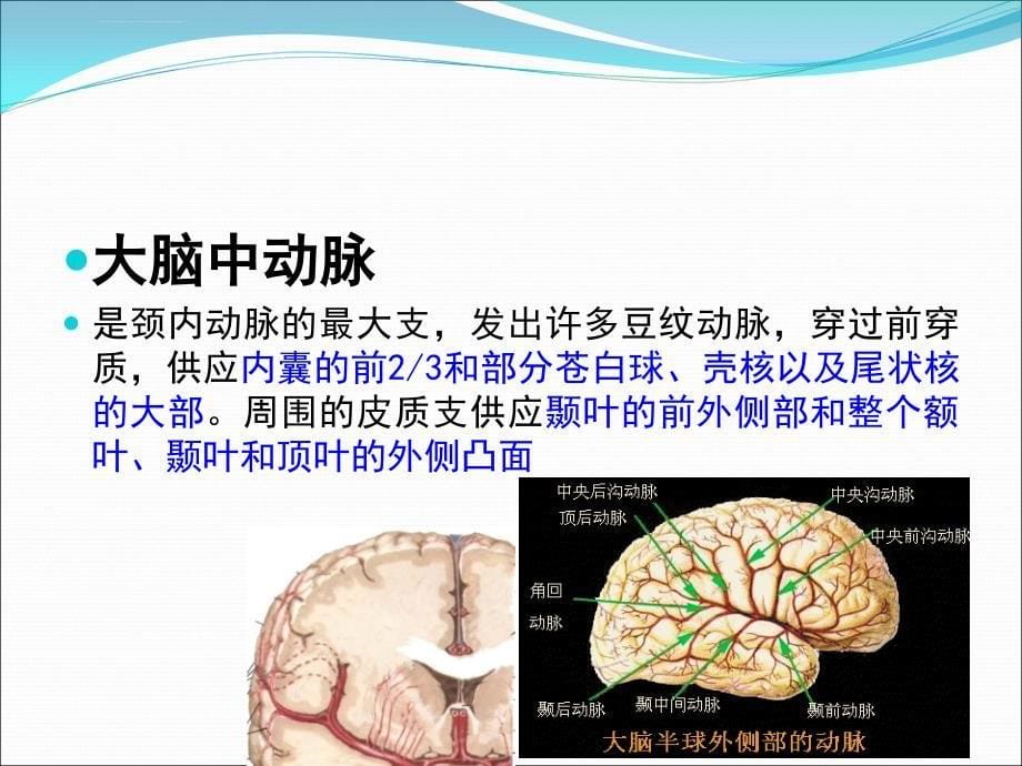 颅脑常见血管疾病ct诊断课件_第5页