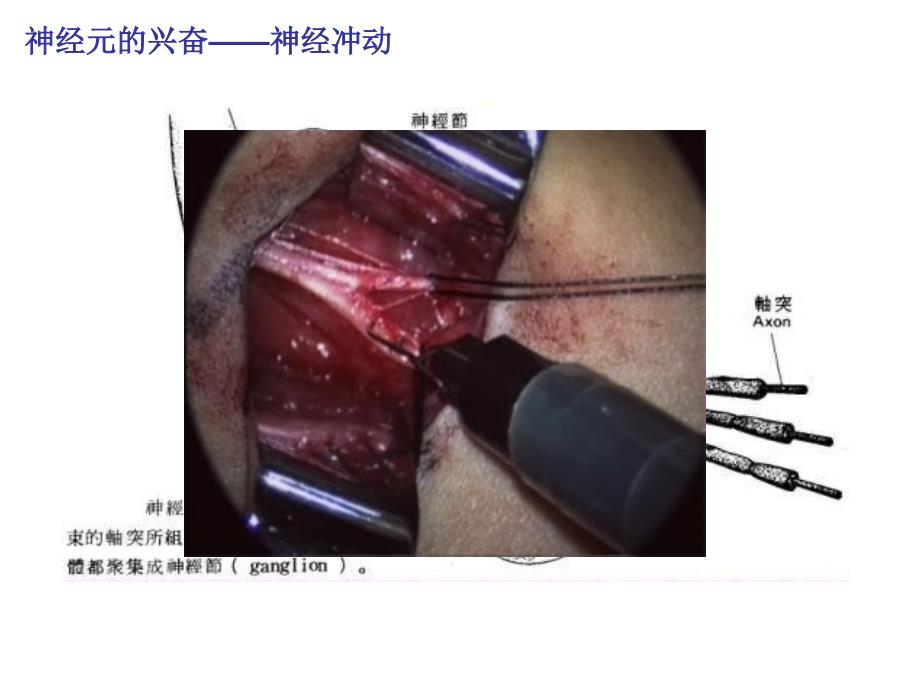 神经系统的结构和功能(上课课件)_第3页