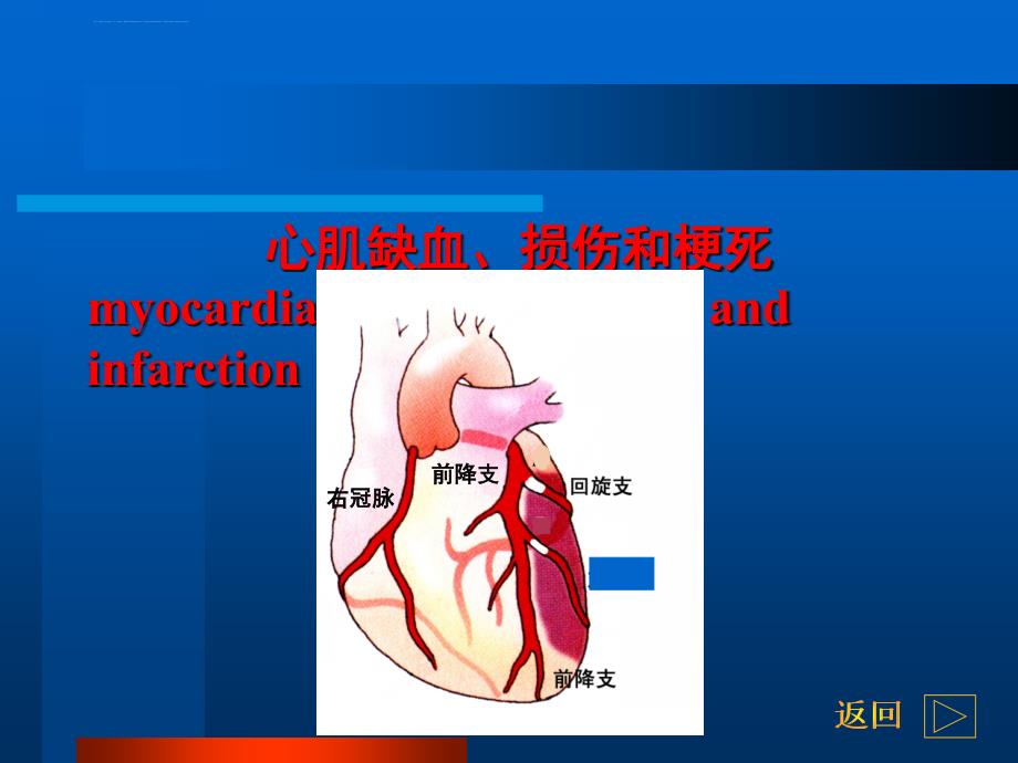 心电图基础知识教程(三)课件_第2页