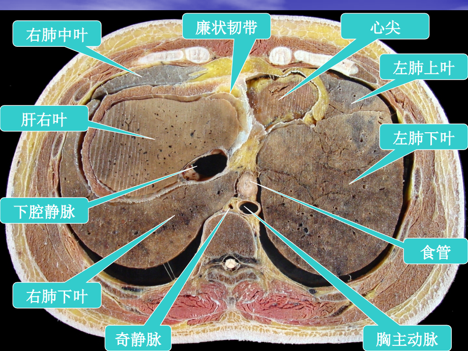 腹部的横断层解剖_第2页